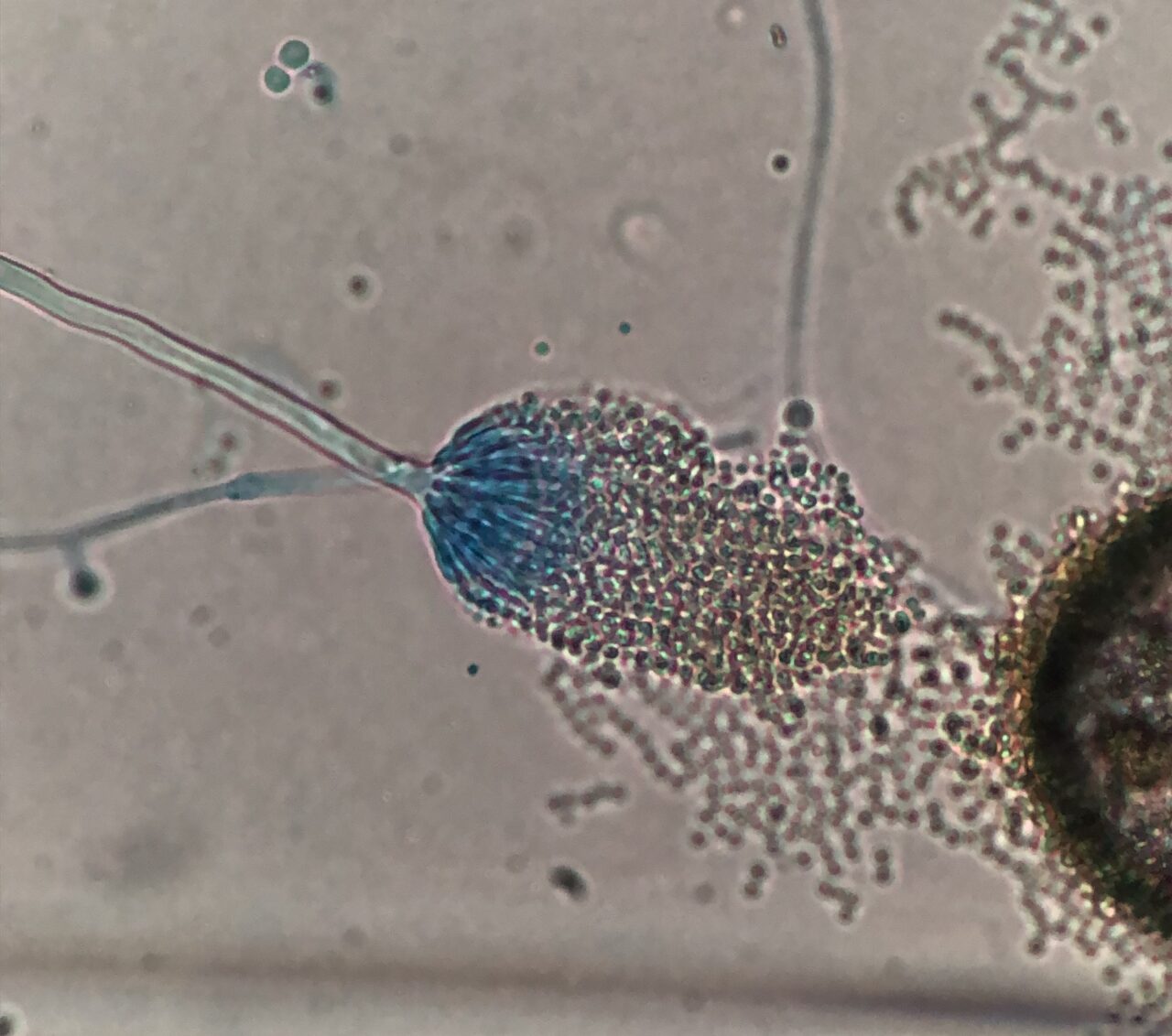 Aspergillus terreus400倍